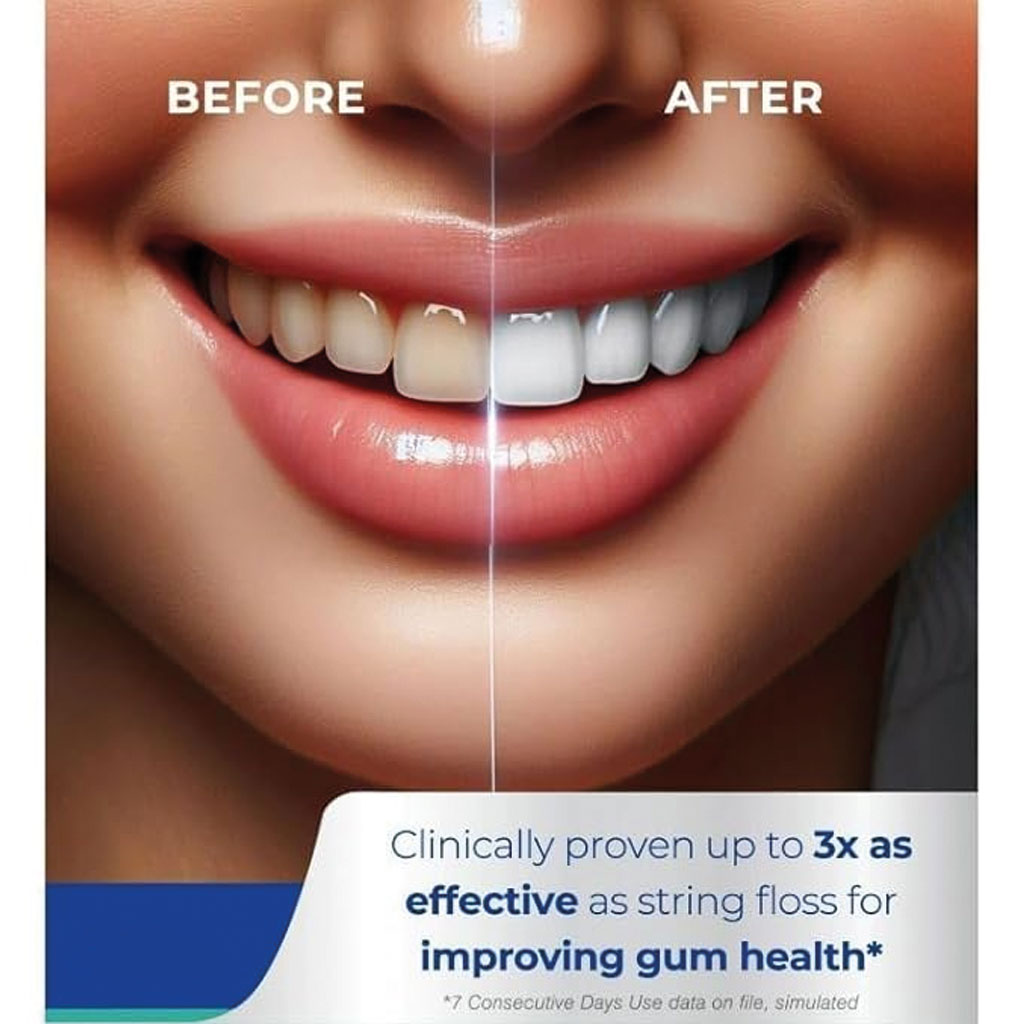 Oral Irrigator Water Flosser